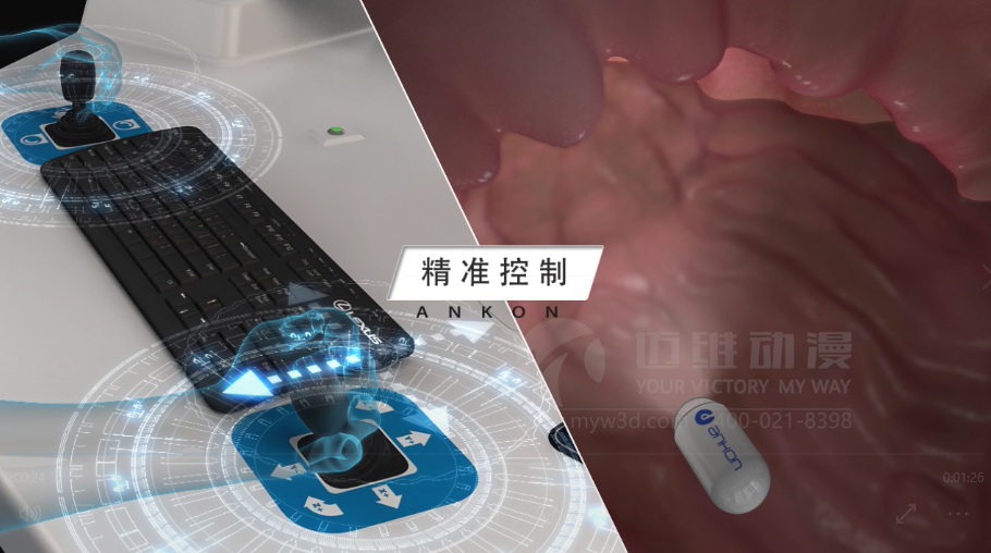 醫(yī)學(xué)醫(yī)療三維動畫 醫(yī)學(xué)醫(yī)療三維動畫