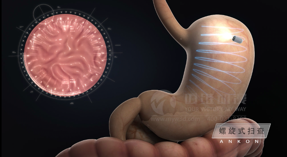 醫(yī)學(xué)醫(yī)療三維動畫 醫(yī)學(xué)醫(yī)療三維動畫