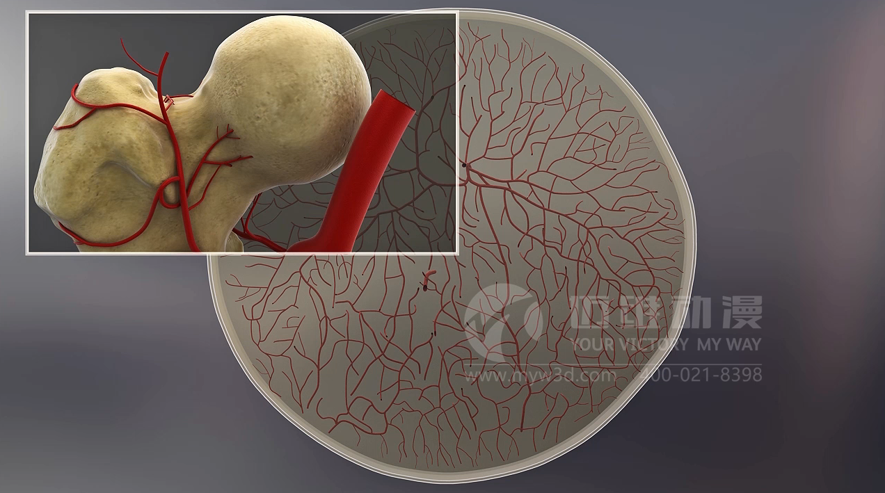 醫(yī)學(xué)醫(yī)療三維動畫 醫(yī)學(xué)醫(yī)療三維動畫