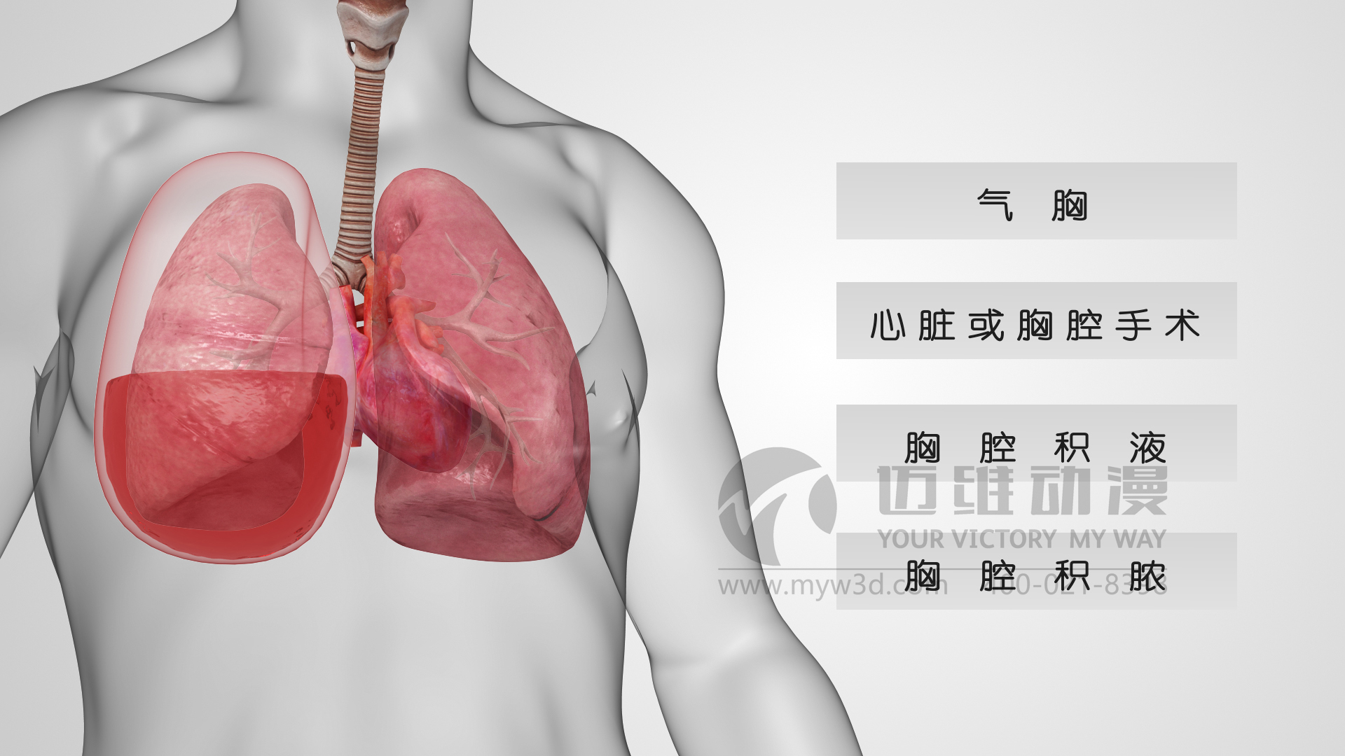 醫療器械動畫.jpg 醫療器械動畫.jpg