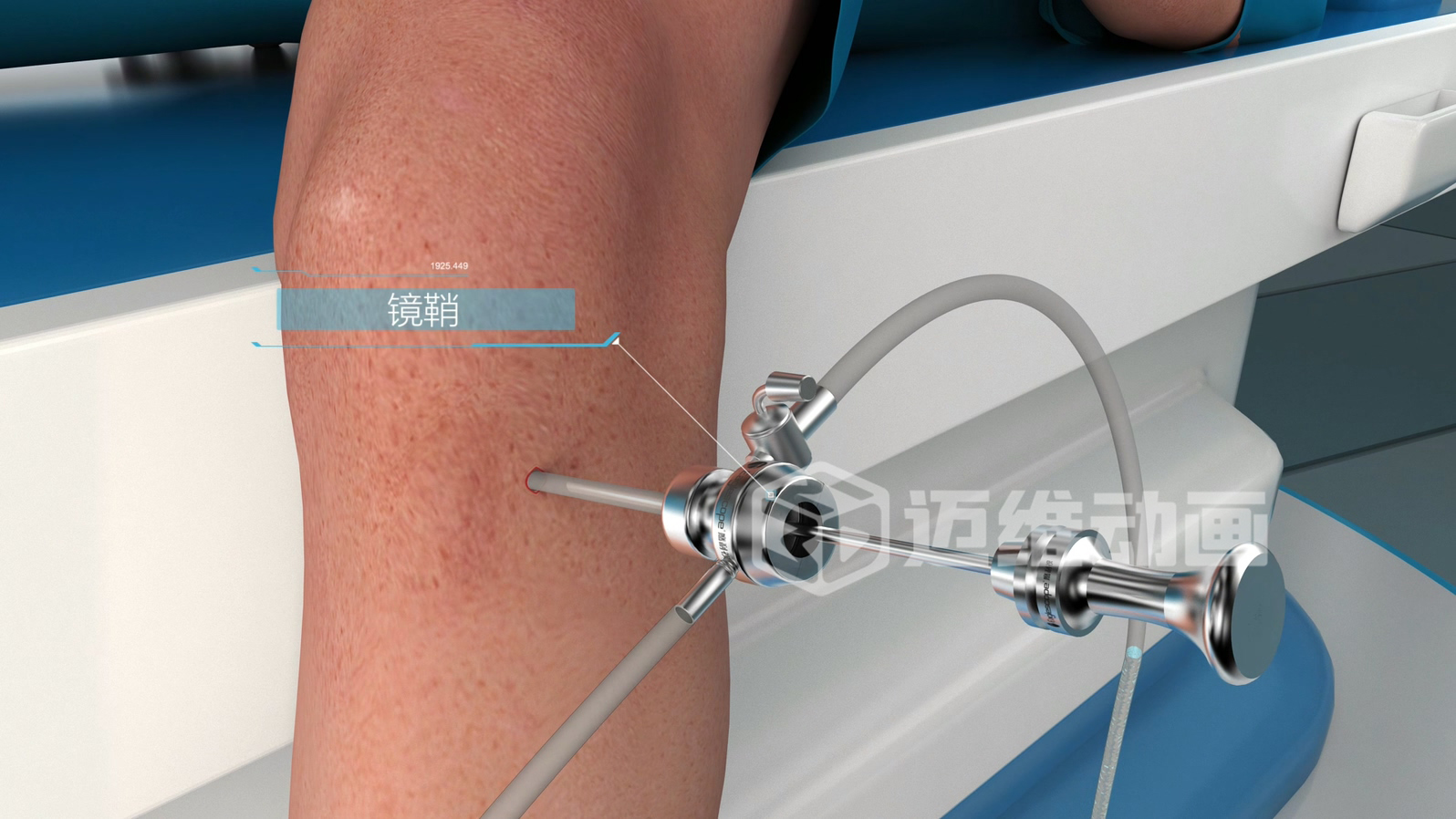 關(guān)節(jié)鏡手術(shù)三維動(dòng)畫(huà) 關(guān)節(jié)鏡手術(shù)三維動(dòng)畫(huà)