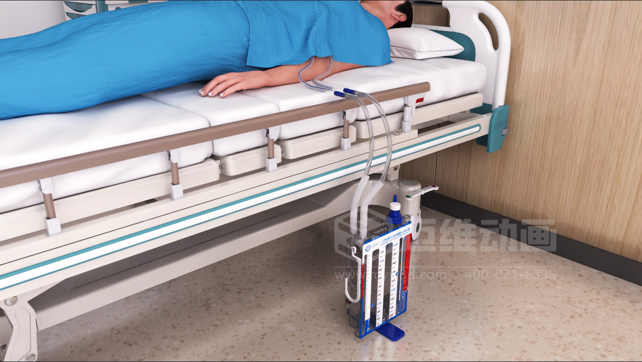 臨床應用新范式三維動畫深度呈現胸腔引流裝置,助力醫療技術高效落地!(圖3) 臨床應用新范式三維動畫深度呈現胸腔引流裝置,助力醫療技術高效落地!(圖3)