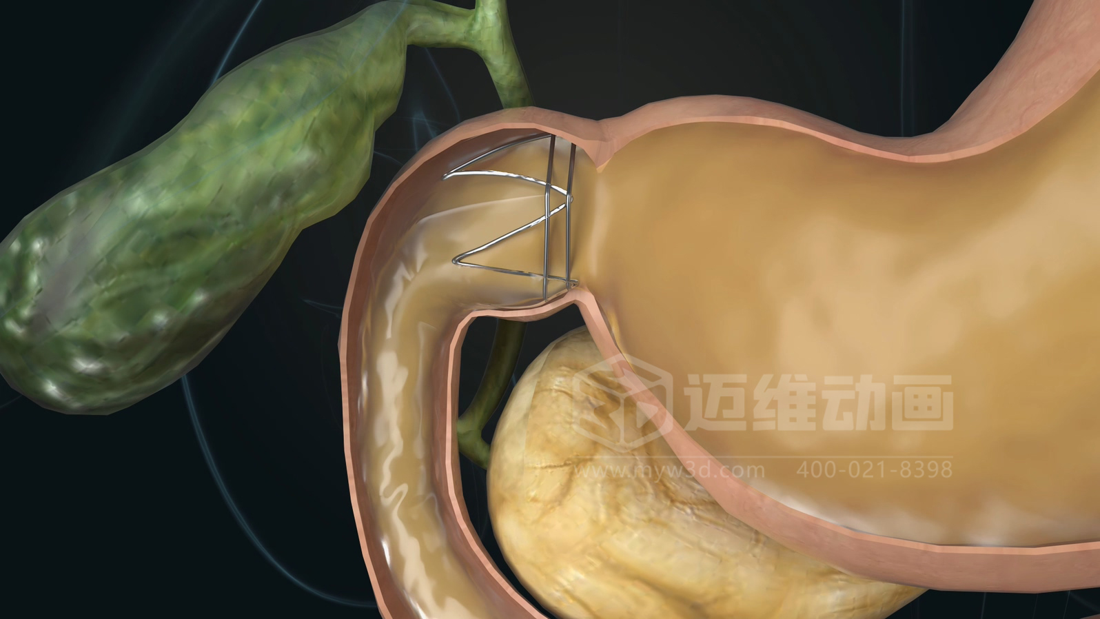 醫(yī)學(xué)科普從來不是 “天書”：三維動畫讓復(fù)雜科學(xué)原理輕松 get！(圖12)
