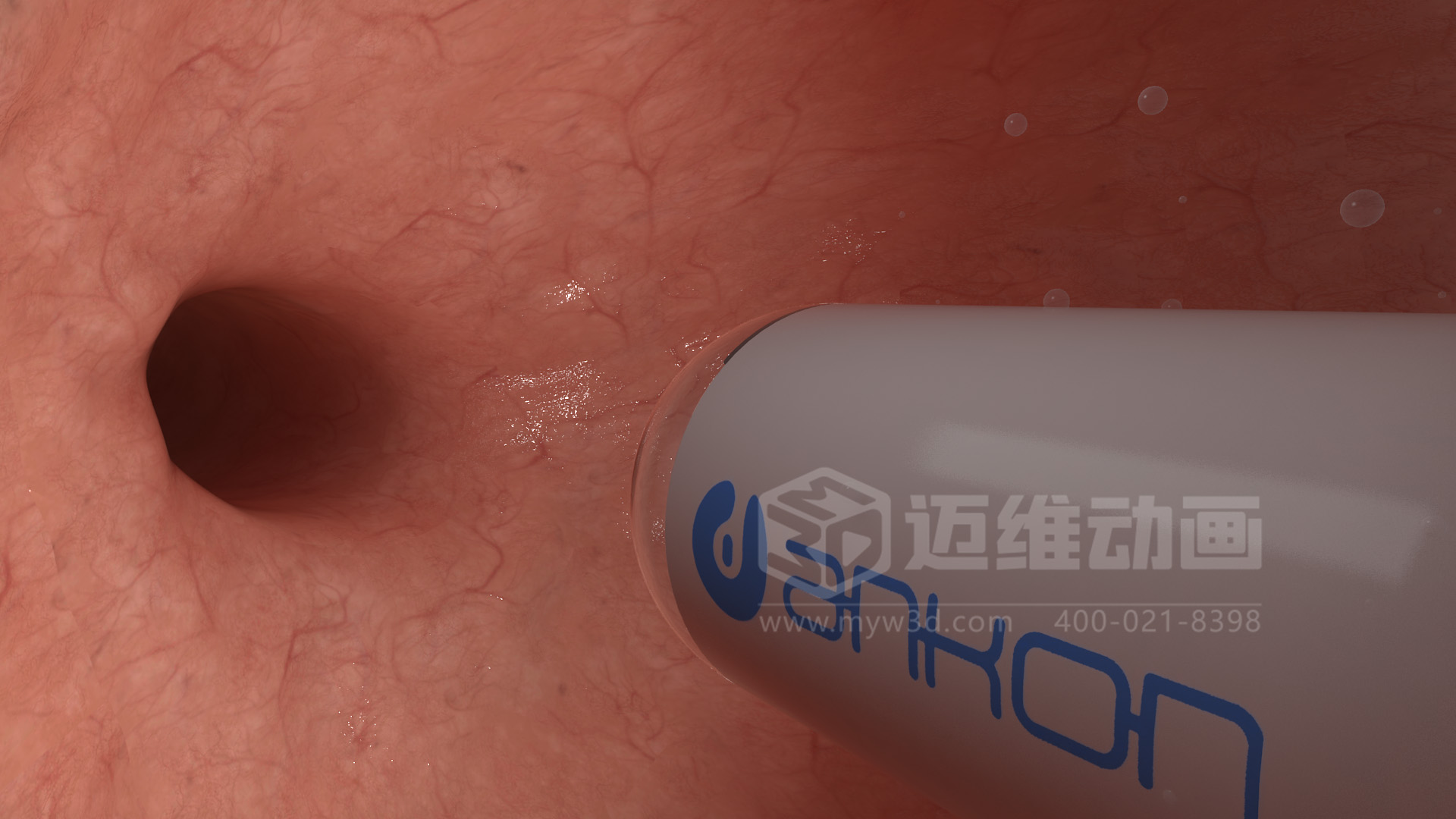醫學檢測設備如何突破消化道檢查壁壘？三維動畫還原核心技術與臨床價值(圖4)