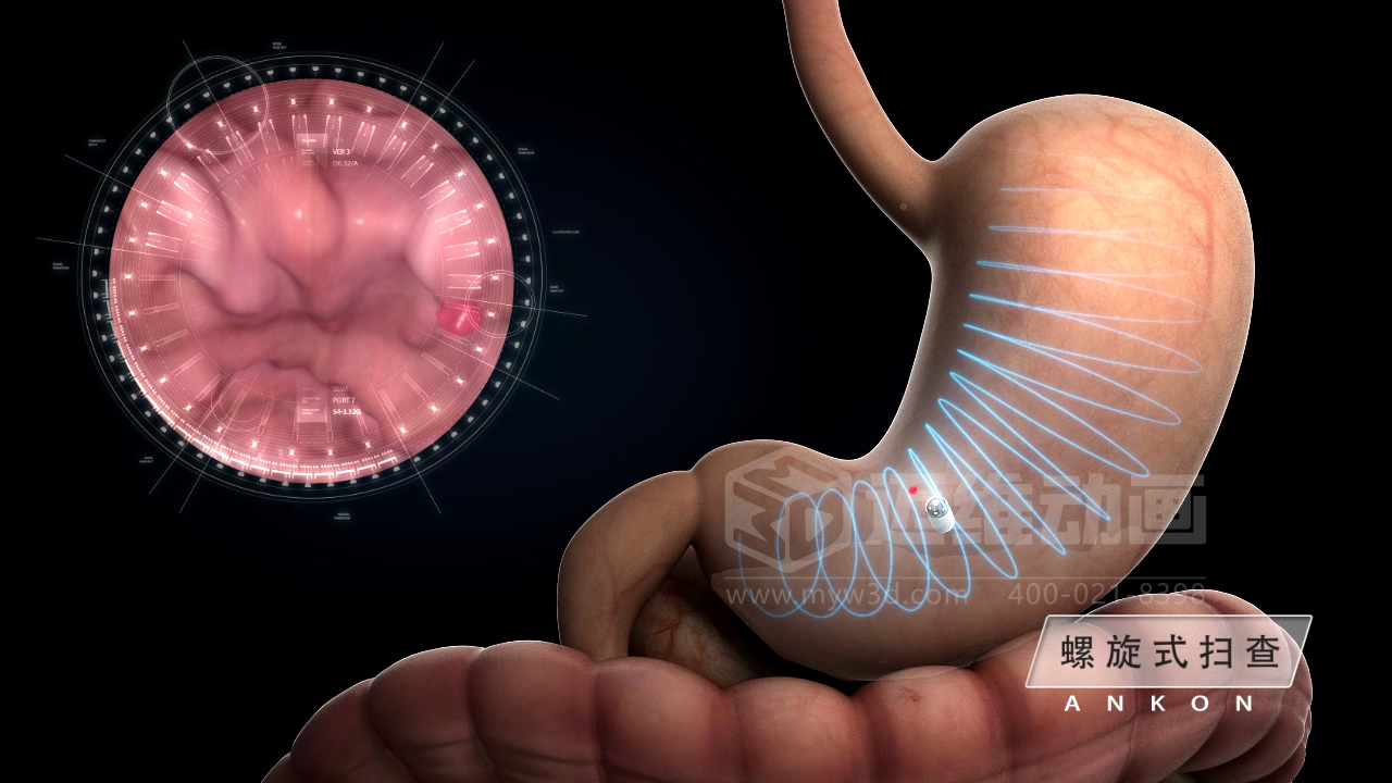 從 “看不懂” 到 “秒懂”,醫(yī)學(xué)醫(yī)療三維動畫憑什么兼顧專業(yè)度與傳播力?(圖5) 從 “看不懂” 到 “秒懂”,醫(yī)學(xué)醫(yī)療三維動畫憑什么兼顧專業(yè)度與傳播力?(圖5)